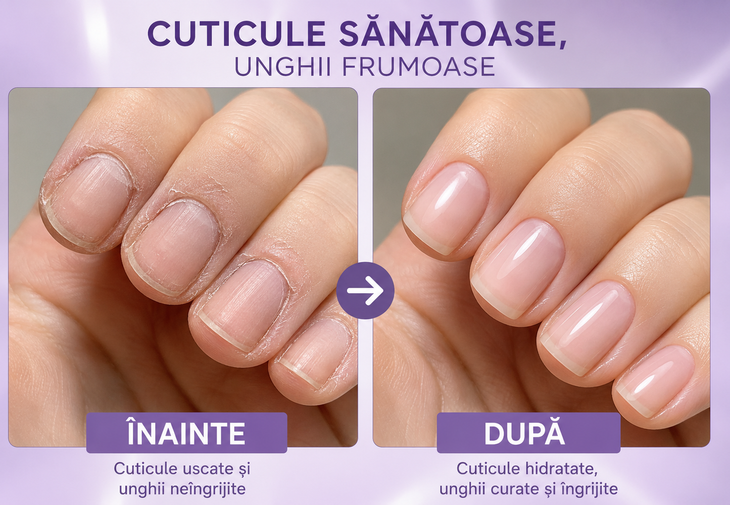 Essence Pen - creion pentru cuticule 1+1 Gratis